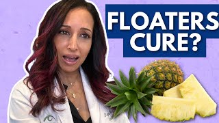 Natural Cure For Eye Floaters Eye Doctor Explains [upl. by Nevlin]