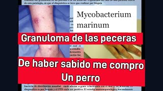 Mycobacterium marinum granuloma de las peceras o acuarios que tan riesgoso es😱😱😱 [upl. by Aubert]