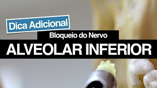 Bloqueio do Nervo Alveolar Inferior  Dicas Adicionais Para Aumentar o seu Sucesso [upl. by Nahseez]