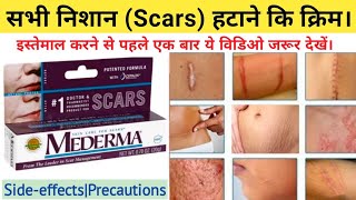 Mederma Cream  mederma for acne scars  mederma advanced scar gel review  Online Pharmacy [upl. by Nadean]