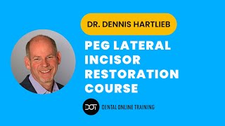 Peg Lateral Incisor Restorations  Dr Dennis Hartlieb  Dental Online Training [upl. by Larisa]