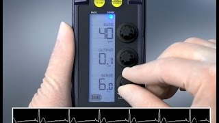 Sensing and Threshold Test — 53401 Temporary Pacemaker [upl. by Eltsirhc894]