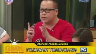 3 Signs of Pulmonary Tuberculosis [upl. by Auhsohey]