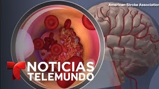 Varias maneras de prevenir un derrame cerebral  Noticiero  Noticias Telemundo [upl. by Aicilram]