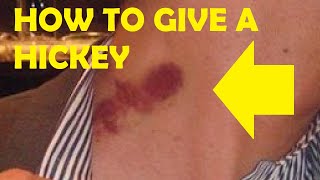 how to give a hickey leaving a mark easy [upl. by Rather764]