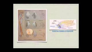 Basiskurs Neurologie Erkrankungen des PNS Teil 1314 [upl. by Merfe]