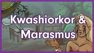 Kwashiorkor vs Marasmus  Nutrition Mnemonic [upl. by Nanji]