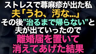 【スカッとする話】 ストレスで蕁麻疹が出た私…夫「うわ、きたな…」治るまで家に帰らないと夫が出ていったので離婚届を置いて消えてあげた結果が…w【修羅場】 [upl. by Kcirtapnhoj]