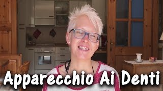 APPARECCHIO ORTODONTICO  Perché Solo Adesso e Prime Impressioni 1 [upl. by Lime]