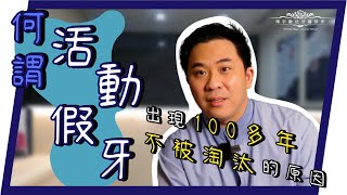 【何謂活動假牙？】不用手術也可以擁有美美好用的牙齒？！CP值超高！＃活動假牙 ＃全口活動假牙 ＃局部活動假牙 ＃假牙保養 ＃假牙選擇＃RPD 環宇數位牙醫診所 [upl. by Alleiram]