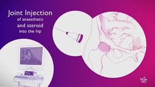 W27 UltrasoundGuided Hip Joint Injections [upl. by Ayiram]