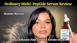 Ordinary MultiPeptide Serum Review  Does Ordinary Hair Growth Serum Actually Work Honest review [upl. by Yelrehs]