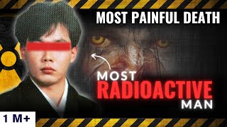 Man Who Died The Most Painful Death ☢️  Horrifying 83 Days  Radiation Disaster [upl. by Elmina898]