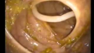 Ascaris Lumbricoides MICROBIOLOGIA Clase Mariella3 [upl. by Phylis]