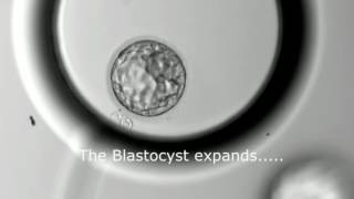 Blastocyst Development  Day 3 to Day 5 MUST SEE [upl. by Dianthe446]