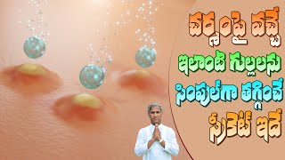 Treatment of Inflammatory Acne  How to Get Rid Of Heat Boils  Dr Manthena Satyanarayana Raju [upl. by Bertolde]