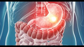 MRCP PART ONEPASSMEDICINE 2021 GASTROENTROLOGY 10 [upl. by Anehsuc]