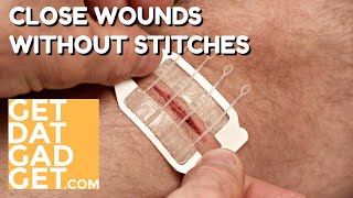 Zipstitch Closes Wounds Without Stitches [upl. by Ariella349]