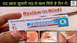 Trioderm Skin Cream  दाद खाज खुजली को मिटाएं  Anti Bacterial Fungal cream  SKMEDICINE [upl. by Avenej]