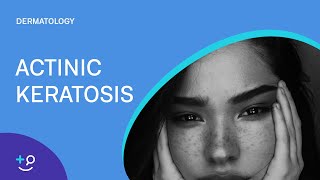 Actinic Keratosis Dermatology [upl. by Elitnahc]