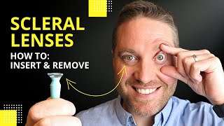 Scleral Lenses Insertion And Removal Plus Pro Tips For Beginners [upl. by Bowler]