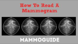 How To Read A Mammogram [upl. by Nylirad]