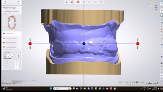 CUDCLD Design with 3D Biteplate [upl. by Suoicul]