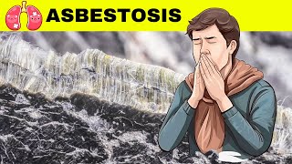 Asbestosis  Causes Pathogenesis Signs amp Symptoms Diagnosis And Treatment [upl. by Dodson304]