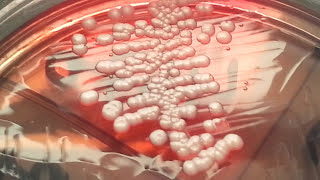 candida growth on Cystine electrolyte Deficient agar  CLED agar [upl. by Iralav]