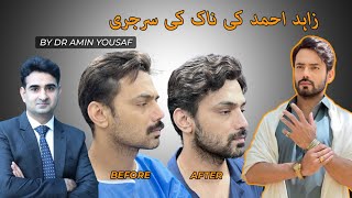 Revision Rhinoplasty Surgery Pakistan  Famous Actor Zahid Ahmad Perfect Nose Surgery Dr Amin Yousaf [upl. by Ydur]