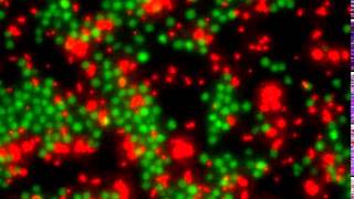 Transdifferentiation in action [upl. by Ailugram695]