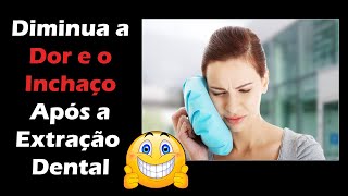 5 Dicas Para Ter um PósOperatório de Extração Dental Sem Dor e Inflamação  Cirurgia no Dentista [upl. by Shirley]