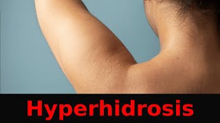 Comprehensive Guide to Hyperhidrosis [upl. by Rothwell]