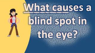 What causes a blind spot in the eye   Top Health FAQ Channel [upl. by Nahgrom489]