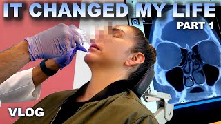 SEPTOPLASTY SURGERY IT CHANGED MY LIFE  VLOG  PART 1 [upl. by Salokin76]