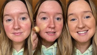 Best affordable foundation for redness and tips on achieving a full coverage [upl. by Soigroeg]