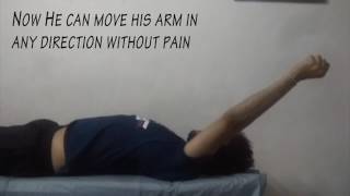 Best Physiotherapy Treatment for post Fracture Shoulder Pain [upl. by Gleda]