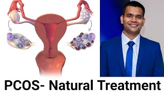 Natural way to treat Polycystic ovarian syndrome PCOSPCOD  Dr Vivek Joshi [upl. by Telfer]