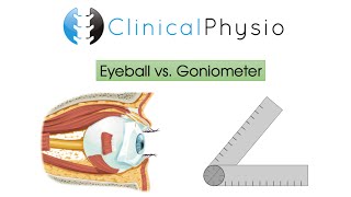 Eyeball vs Goniometer 1  Clinical Physio [upl. by Wunder]