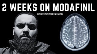 MODAFINIL EXPLAINED  2 WEEK EXPERIENCE UPDATE [upl. by Madlen]