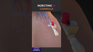 Injected IV Cannula With Sticking Plaster shorts education [upl. by Breana]