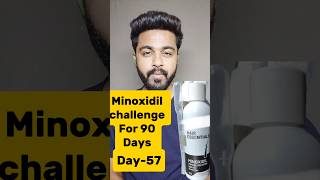 Minoxidil challenge For90 DaysDay57haircare minoxidilresult viralreels viralshorts hairfall [upl. by Annemarie682]