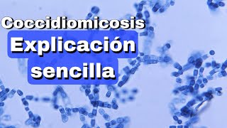 Coccidiomicosis fácil explicación [upl. by Ahseinek878]