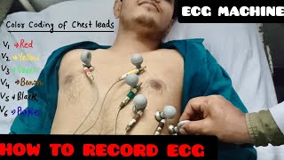 How To Record ECG  ECG leads Color Coding And Placement Location  ECG Machine [upl. by Xenos]