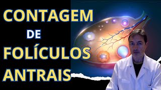 Contagem de Folículos Antrais  Reserva ovariana [upl. by Ikeda]