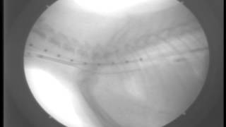 Primary Tracheal Collapse7DAY6FluoroscopyStent Placement [upl. by Berneta]