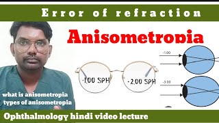 anisometropia  error of refraction  what is anisometropia  anisometropia  optometryhindi [upl. by Casimir135]