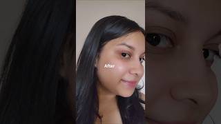 Skincare Routine for oily acne prone skin🎀 skincare glassskin skincareroutine oilyskin acne [upl. by Broadbent]