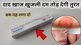 दाद खाज खुजली दम तोड़ देगी तुरंत बस यह लगा दो  Paamderm Plus Cream To Treat Fungal Infection [upl. by Somerville]