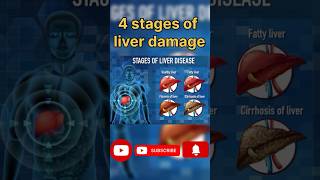 Stage of Liver damage disease liver damage stages spsaklani0888 ytshorts shorts viralshorts [upl. by Gerladina]